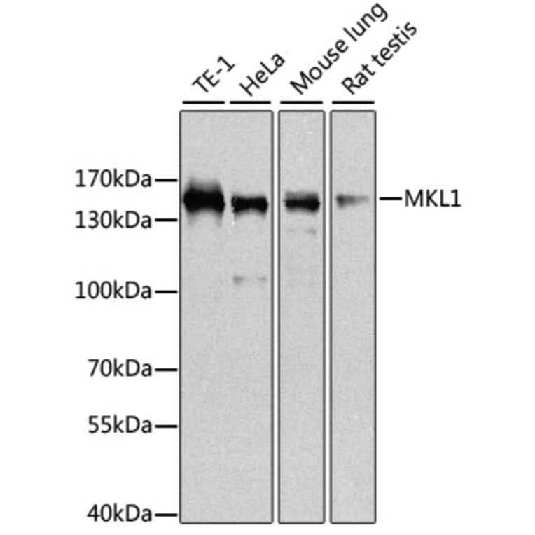 Western Blot - Anti-Mkl1/MRTFA Antibody (A16215) - Antibodies.com
