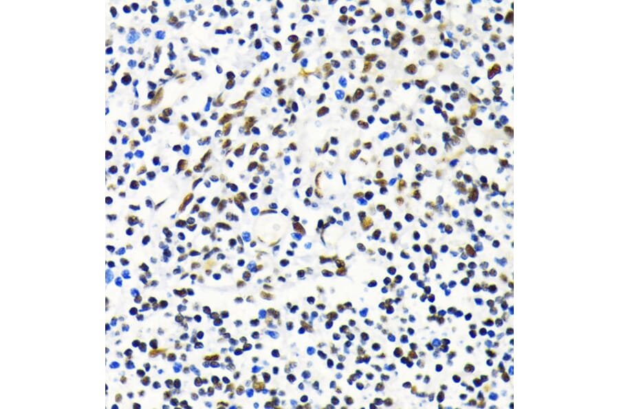 Immunohistochemistry - Anti-Mkl1/MRTFA Antibody (A16215) - Antibodies.com
