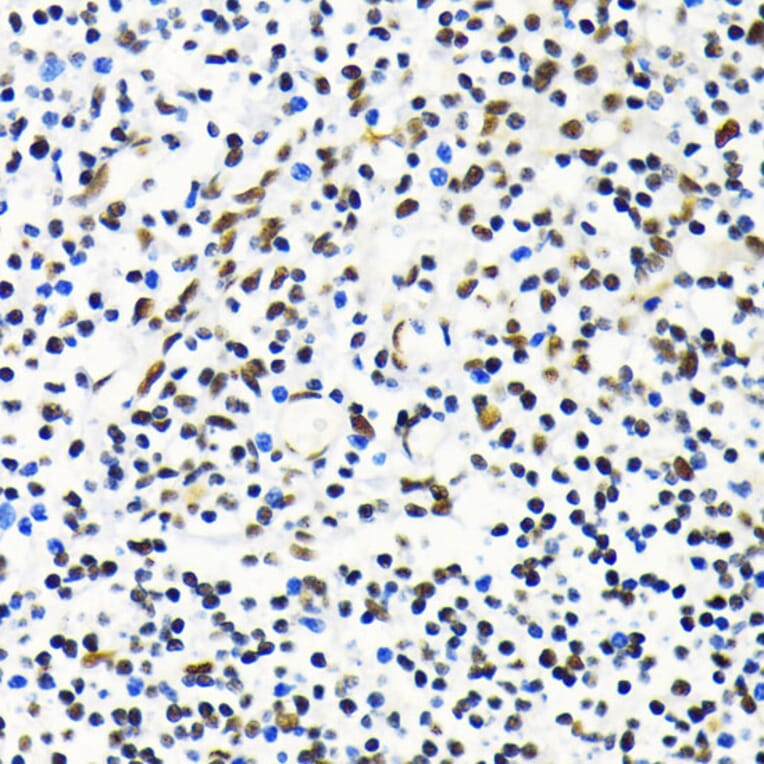 Immunohistochemistry - Anti-Mkl1/MRTFA Antibody (A16215) - Antibodies.com