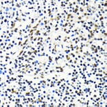 Immunohistochemistry - Anti-Mkl1/MRTFA Antibody (A16215) - Antibodies.com
