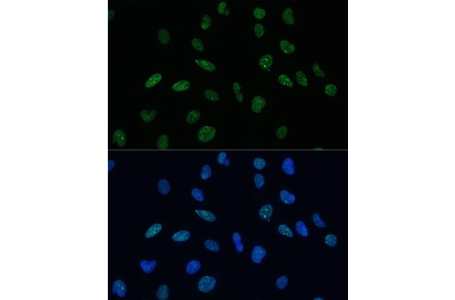 Immunofluorescence - Anti-Mkl1/MRTFA Antibody (A16215) - Antibodies.com