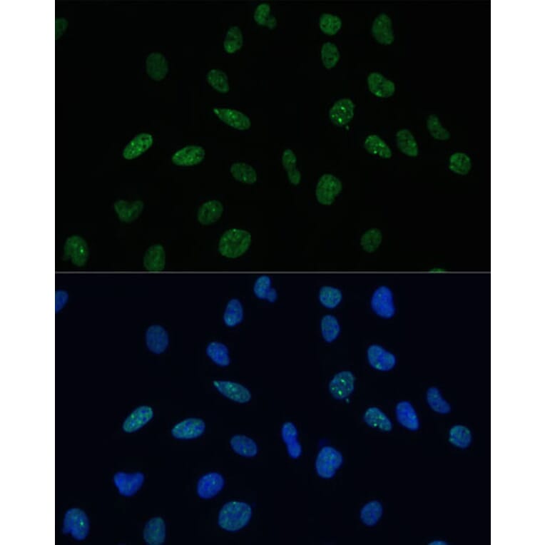 Immunofluorescence - Anti-Mkl1/MRTFA Antibody (A16215) - Antibodies.com