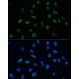 Immunofluorescence - Anti-Mkl1/MRTFA Antibody (A16215) - Antibodies.com