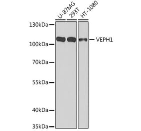 Western Blot - Anti-VEPH1 Antibody (A16216) - Antibodies.com