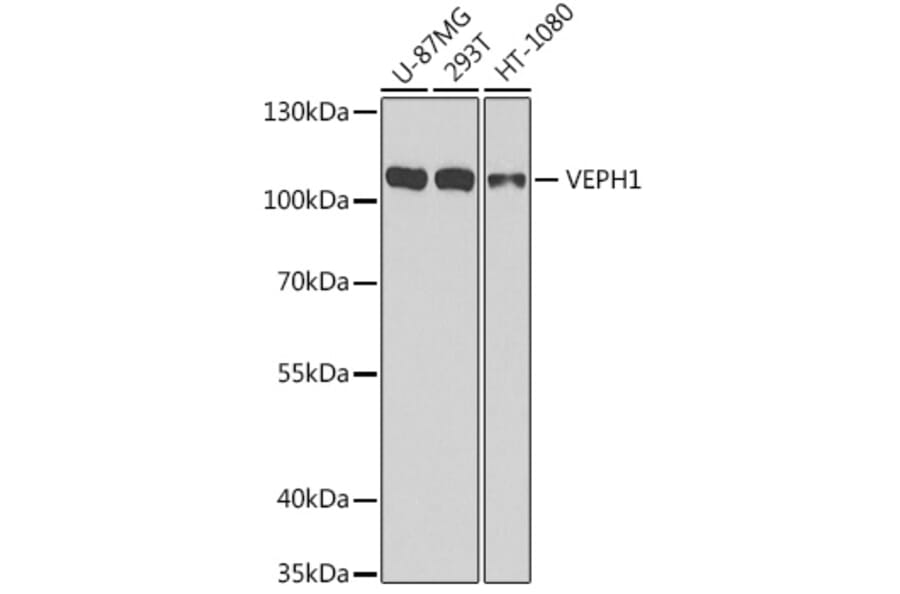 Western Blot - Anti-VEPH1 Antibody (A16216) - Antibodies.com