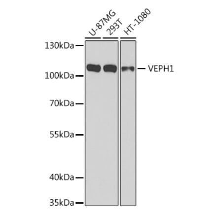 Western Blot - Anti-VEPH1 Antibody (A16216) - Antibodies.com
