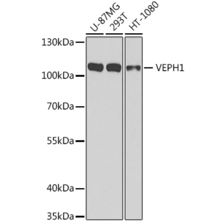 Western Blot - Anti-VEPH1 Antibody (A16216) - Antibodies.com