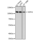 Western Blot - Anti-VEPH1 Antibody (A16216) - Antibodies.com
