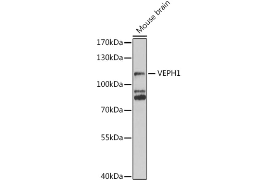 Western Blot - Anti-VEPH1 Antibody (A16216) - Antibodies.com