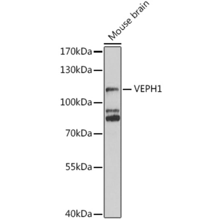 Western Blot - Anti-VEPH1 Antibody (A16216) - Antibodies.com