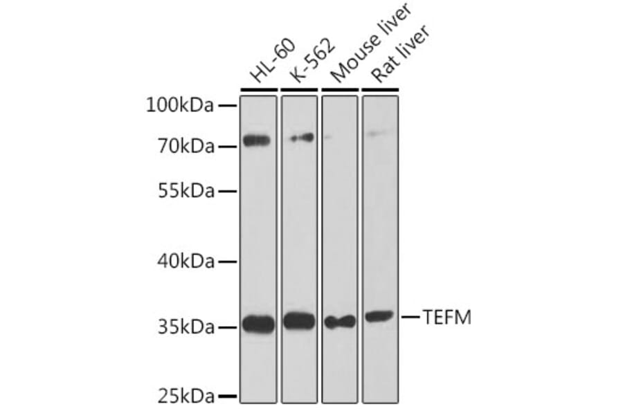Western Blot - Anti-TEFM Antibody (A16217) - Antibodies.com