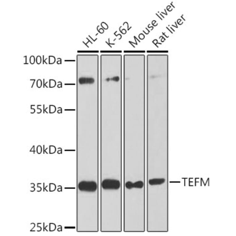 Western Blot - Anti-TEFM Antibody (A16217) - Antibodies.com