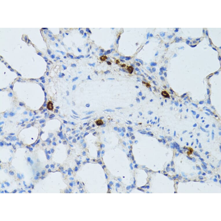 Immunohistochemistry - Anti-TEFM Antibody (A16217) - Antibodies.com