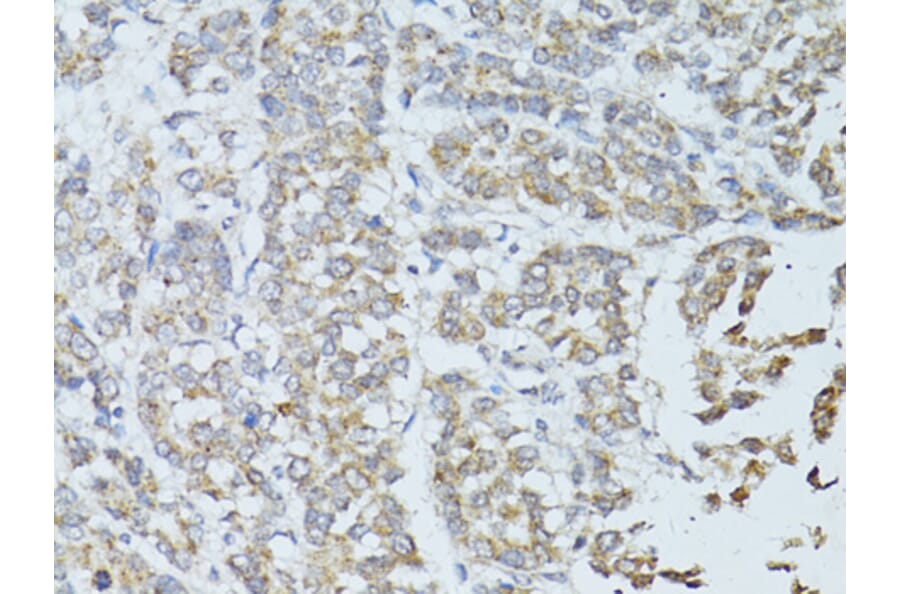 Immunohistochemistry - Anti-TEFM Antibody (A16217) - Antibodies.com
