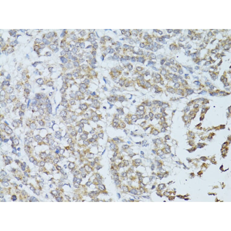 Immunohistochemistry - Anti-TEFM Antibody (A16217) - Antibodies.com