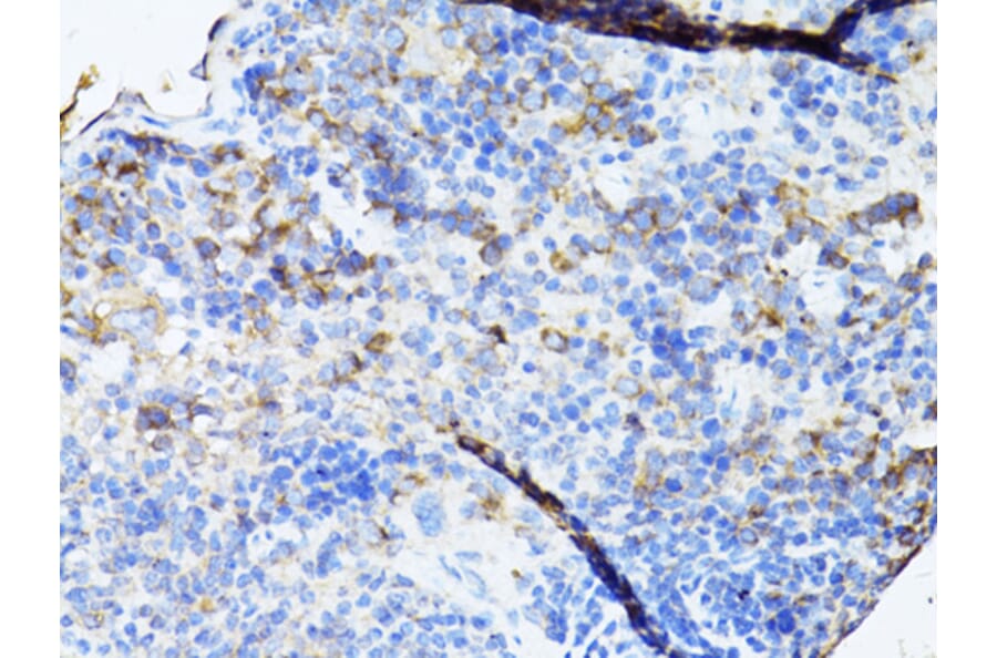 Immunohistochemistry - Anti-TEFM Antibody (A16217) - Antibodies.com