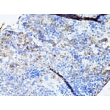 Immunohistochemistry - Anti-TEFM Antibody (A16217) - Antibodies.com