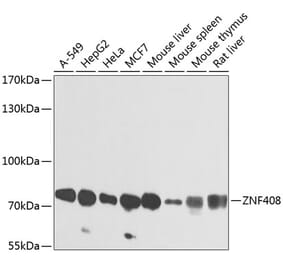 Western Blot - Anti-ZNF408 Antibody (A16218) - Antibodies.com
