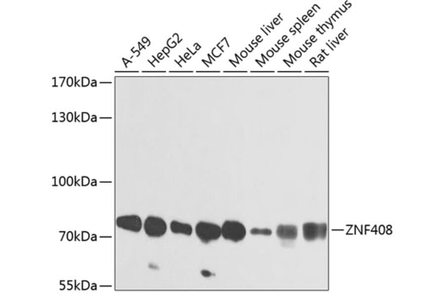 Western Blot - Anti-ZNF408 Antibody (A16218) - Antibodies.com