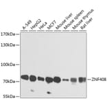 Western Blot - Anti-ZNF408 Antibody (A16218) - Antibodies.com