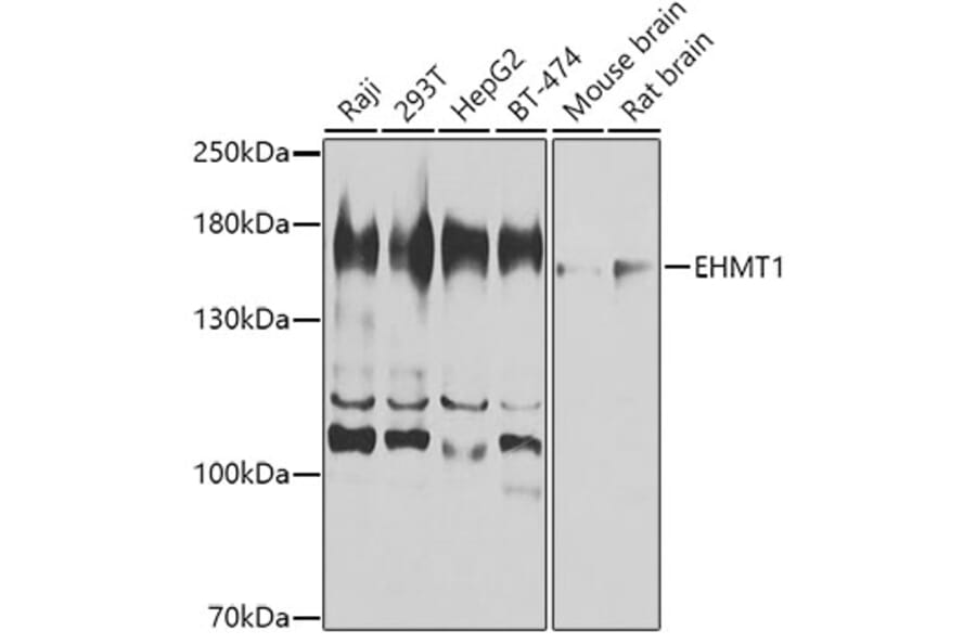 Western Blot - Anti-EHMT1/GLP Antibody (A16219) - Antibodies.com