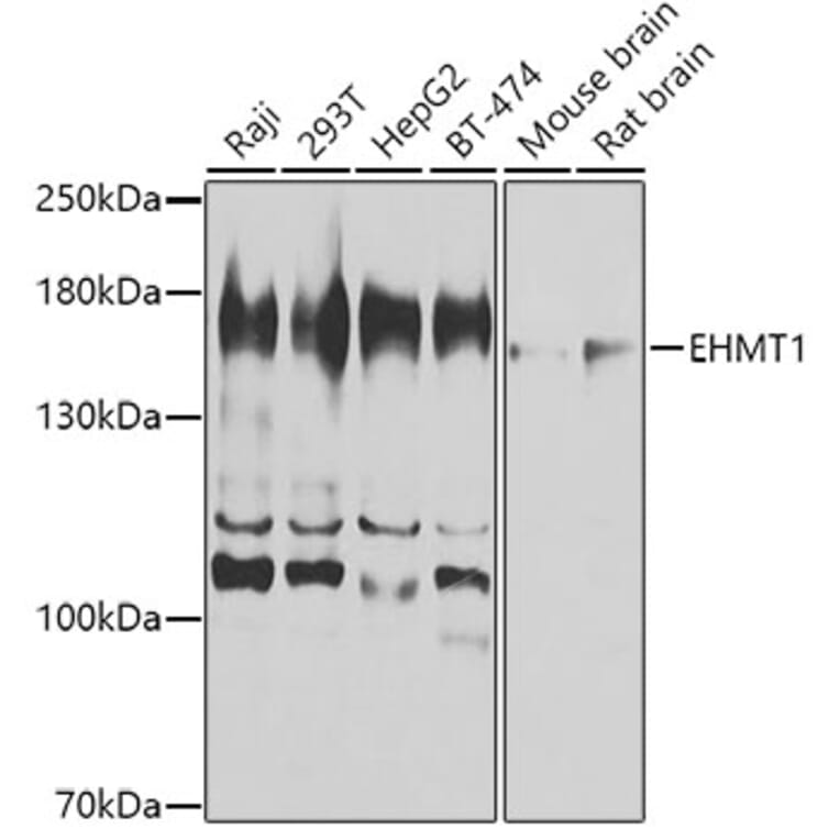 Western Blot - Anti-EHMT1/GLP Antibody (A16219) - Antibodies.com