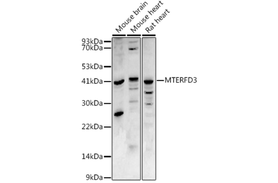 Western Blot - Anti-MTERFD3/MTERF2 Antibody (A16221) - Antibodies.com