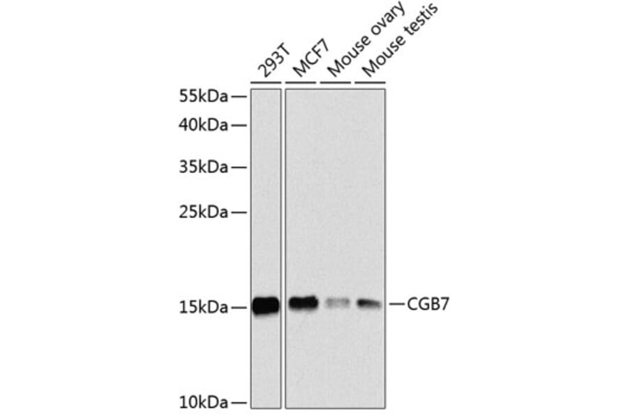 Western Blot - Anti-hCG beta Antibody (A16222) - Antibodies.com