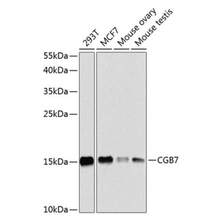 Western Blot - Anti-hCG beta Antibody (A16222) - Antibodies.com
