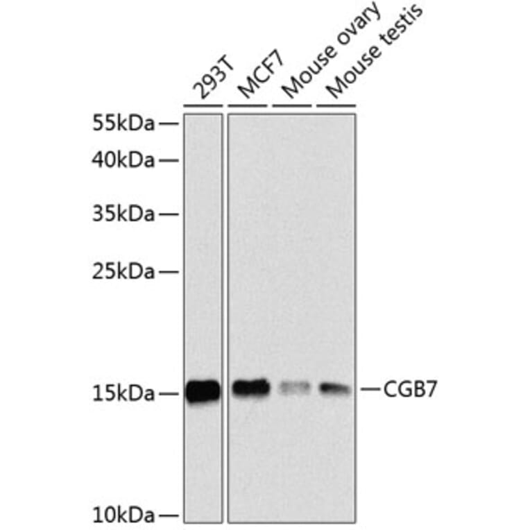 Western Blot - Anti-hCG beta Antibody (A16222) - Antibodies.com