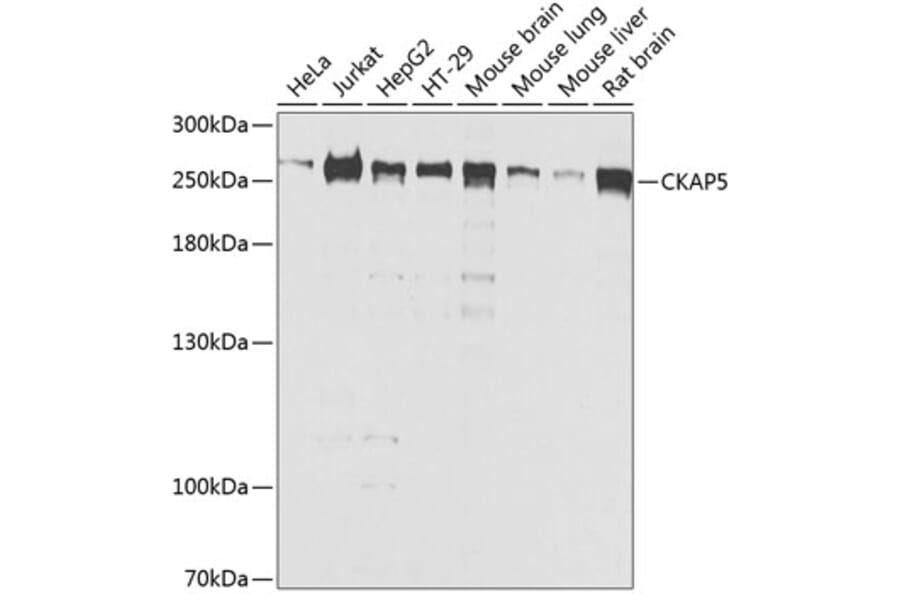 Western Blot - Anti-ch TOG Antibody (A16224) - Antibodies.com