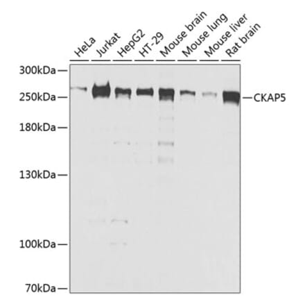 Western Blot - Anti-ch TOG Antibody (A16224) - Antibodies.com