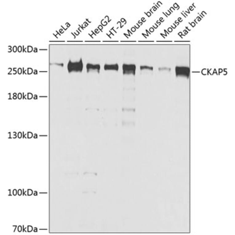 Western Blot - Anti-ch TOG Antibody (A16224) - Antibodies.com