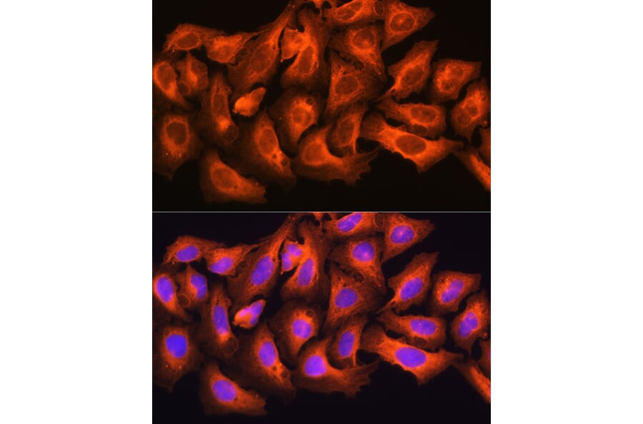 Immunofluorescence - Anti-ch TOG Antibody (A16224) - Antibodies.com