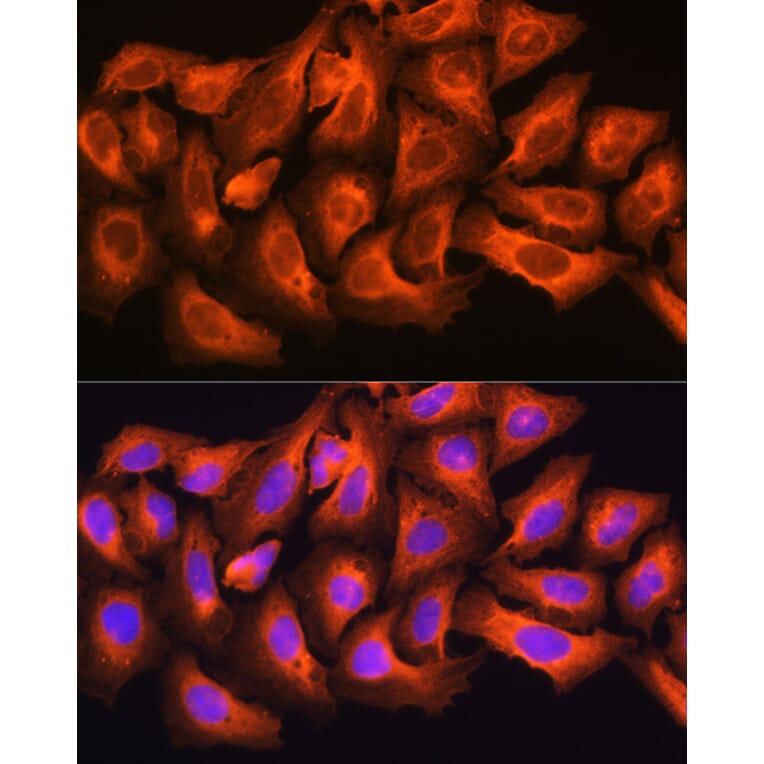 Immunofluorescence - Anti-ch TOG Antibody (A16224) - Antibodies.com