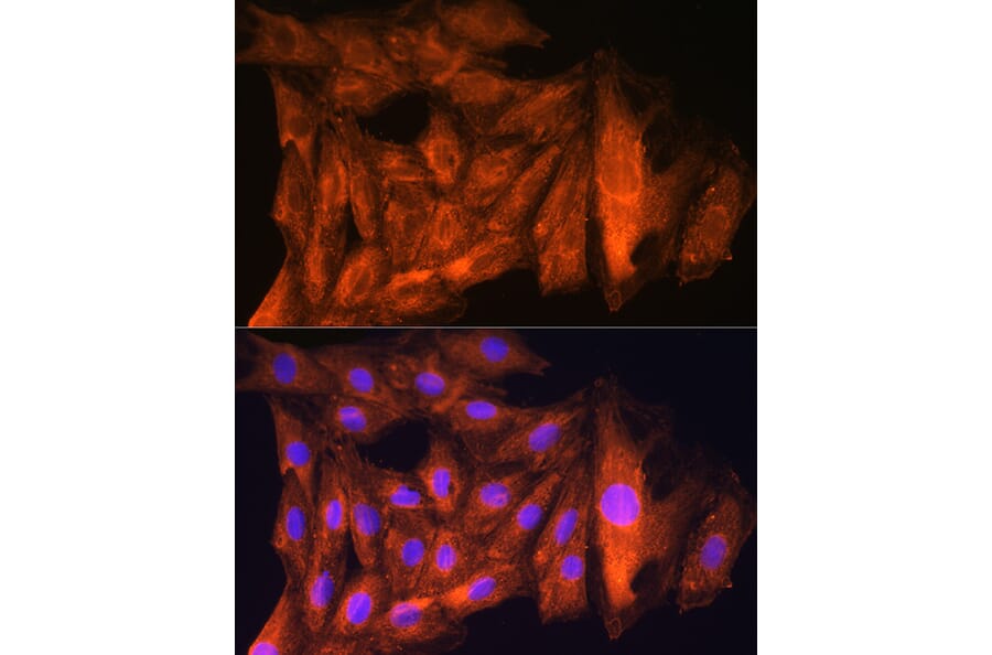 Immunofluorescence - Anti-ch TOG Antibody (A16224) - Antibodies.com