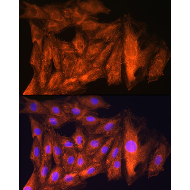 Immunofluorescence - Anti-ch TOG Antibody (A16224) - Antibodies.com