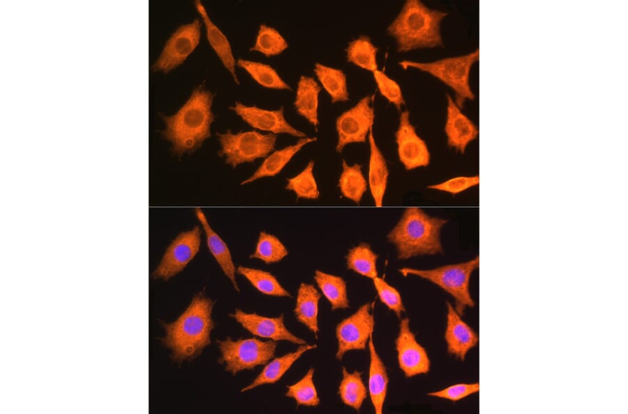 Immunofluorescence - Anti-ch TOG Antibody (A16224) - Antibodies.com
