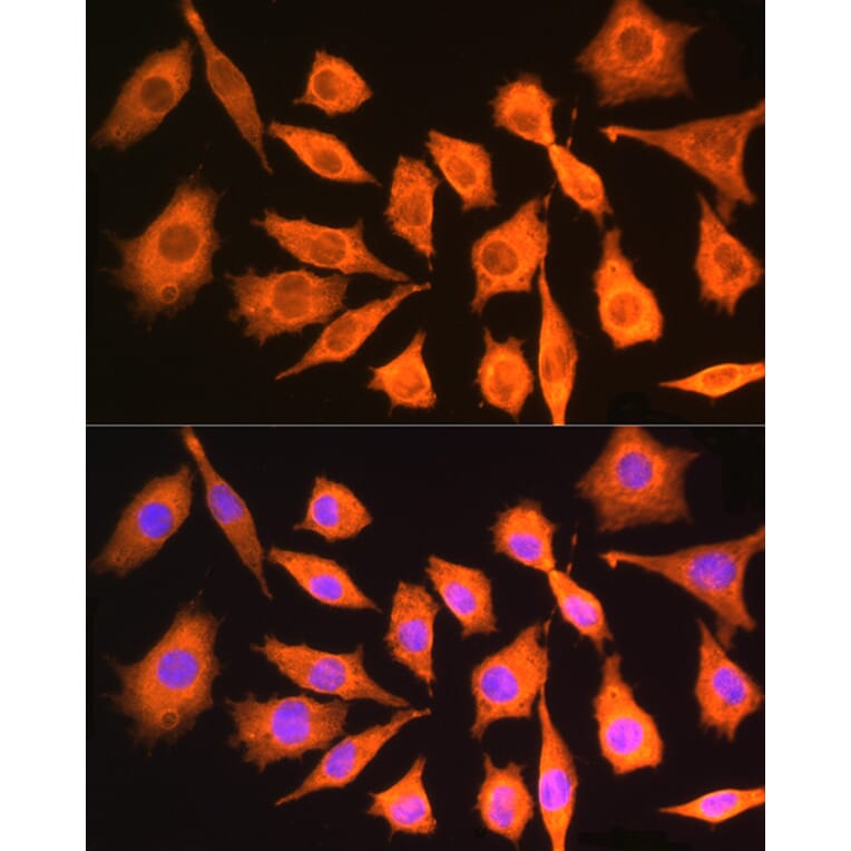 Immunofluorescence - Anti-ch TOG Antibody (A16224) - Antibodies.com