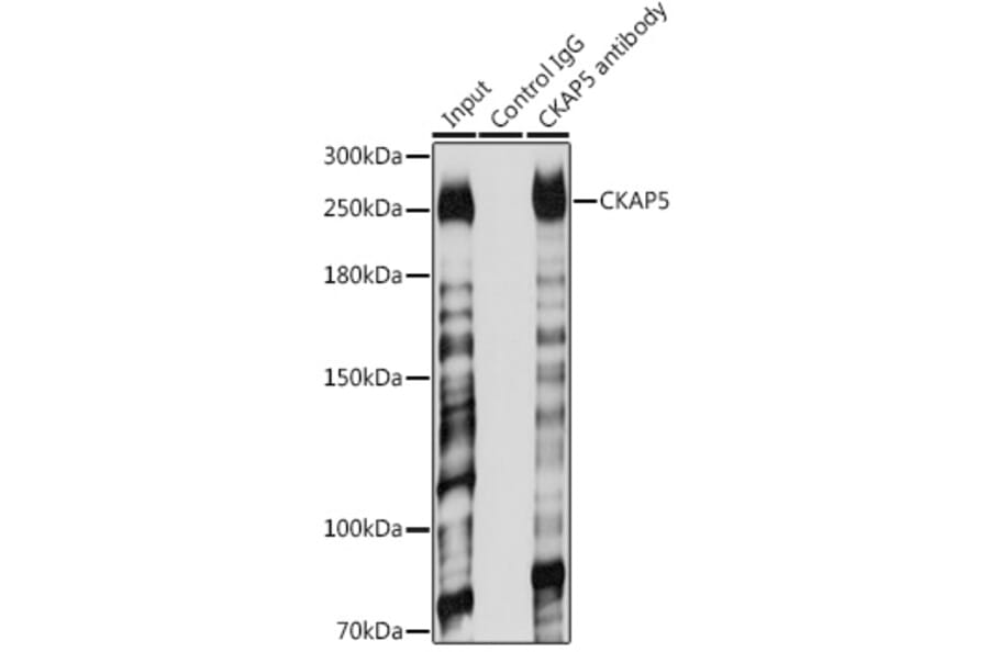 Western Blot - Anti-ch TOG Antibody (A16224) - Antibodies.com