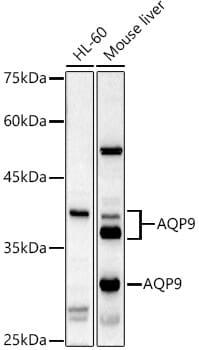 Western blot analysis of extracts of various cell lines, using Anti-AQP9 Antibody (A8540) at 1:1,000 dilution.
Secondary antibody: Goat Anti-Rabbit IgG (H+L) (HRP) (AS014) at 1:10,000 dilution.
Lysates / proteins: 25µg per lane.
Blocking buffer: 3% non-fat dry milk in TBST.
Detection: ECL Basic Kit (RM00020).
Exposure time: 90s.