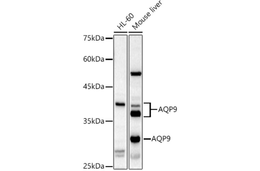 Western Blot - Anti-Aquaporin 9/AQP-9 Antibody (A16225) - Antibodies.com