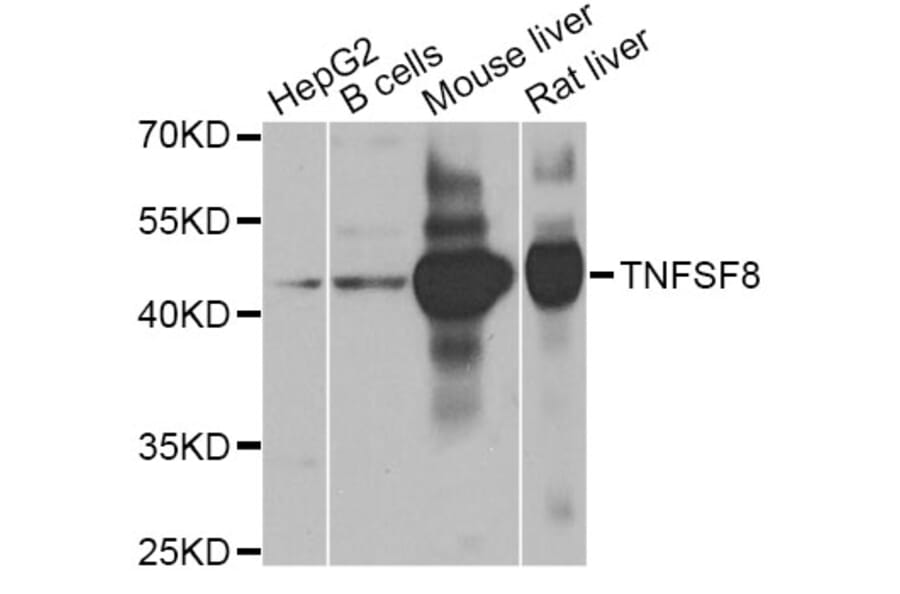 Western Blot - Anti-TNFSF8 Antibody (A8541) - Antibodies.com