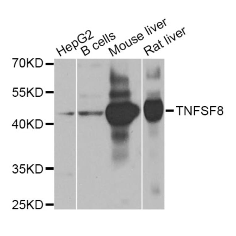 Western Blot - Anti-TNFSF8 Antibody (A8541) - Antibodies.com