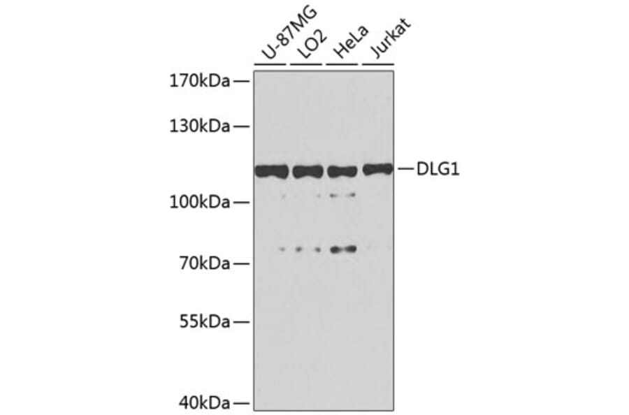 Western Blot - Anti-SAP97 Antibody (A16227) - Antibodies.com