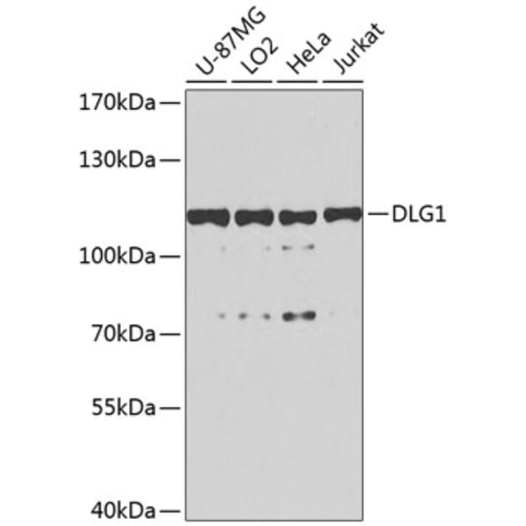 Western Blot - Anti-SAP97 Antibody (A16227) - Antibodies.com