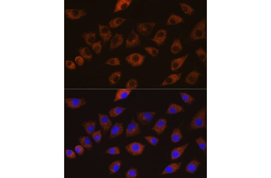 Immunofluorescence - Anti-SAP97 Antibody (A16227) - Antibodies.com