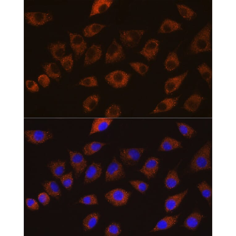 Immunofluorescence - Anti-SAP97 Antibody (A16227) - Antibodies.com