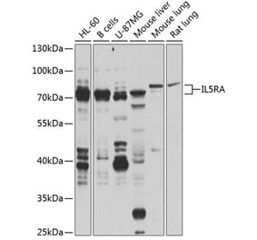 Western Blot - Anti-IL-5RA Antibody (A16228) - Antibodies.com