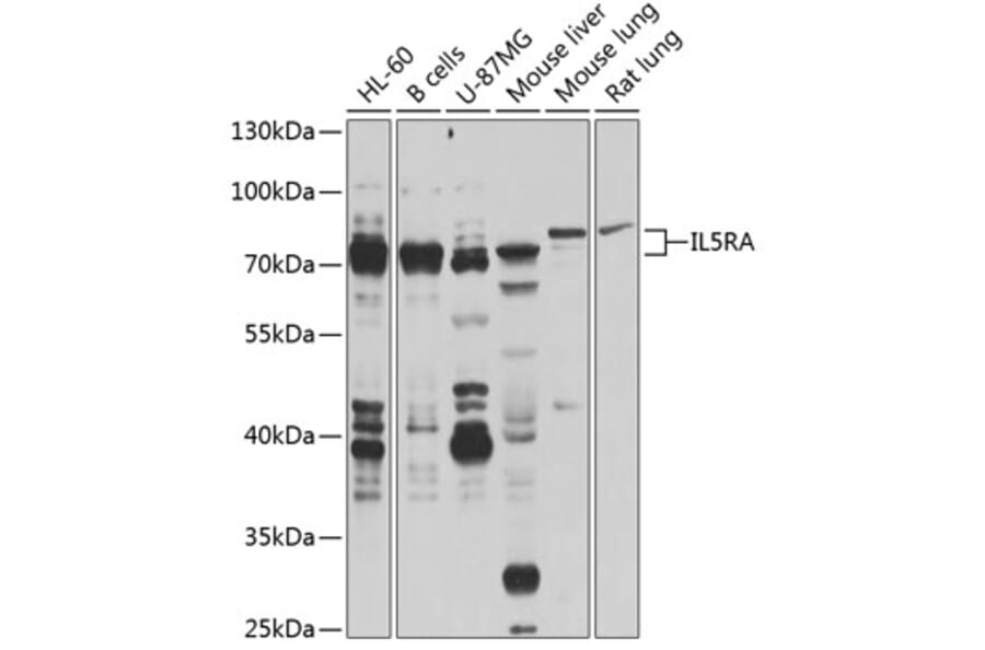 Western Blot - Anti-IL-5RA Antibody (A16228) - Antibodies.com